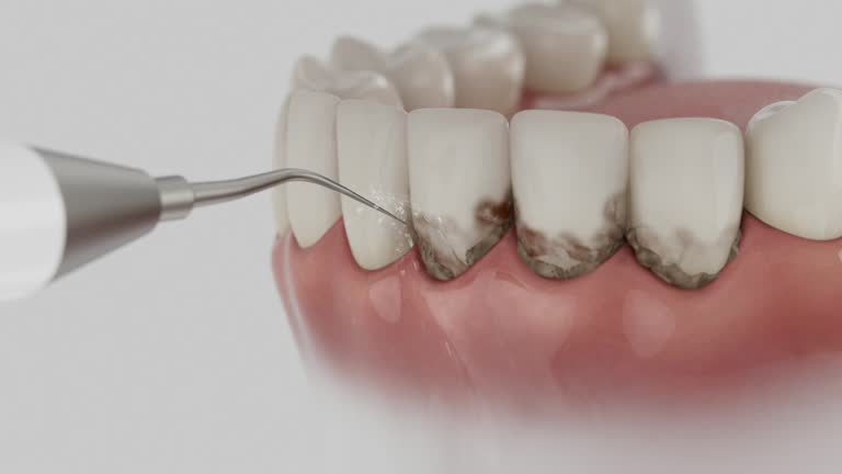 Trusted Tooth Extraction service in Honeygo, MD - Dentist Open Now